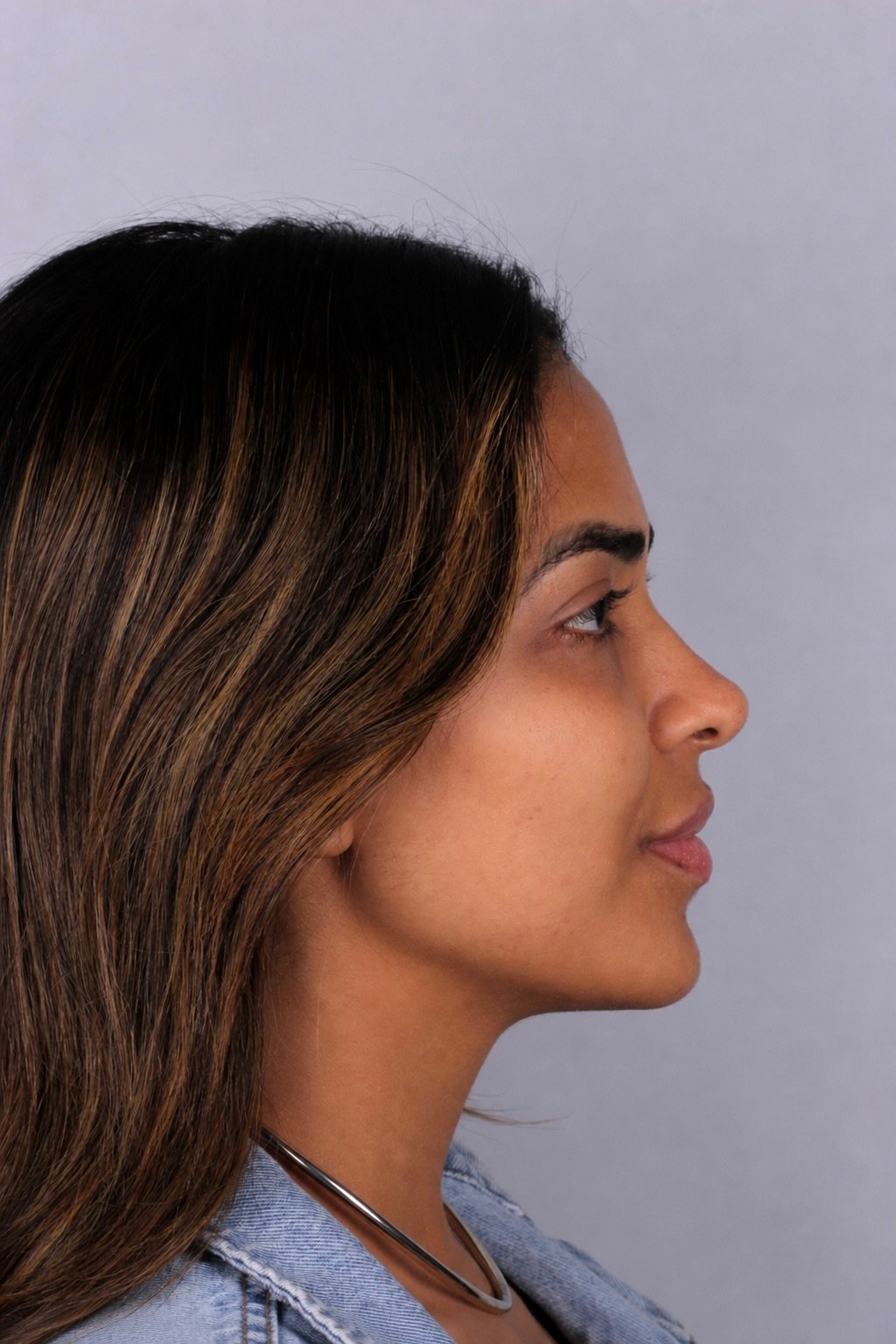 Caso de harmonização orofacial realizado na Oral Feira